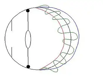 Врождённые изменения сетчатки глаза человека