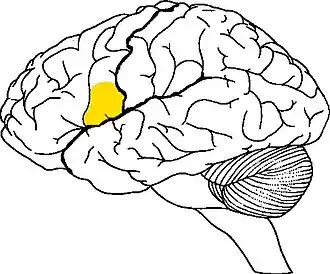 Зона поражения головного мозга при синтаксической афазии.