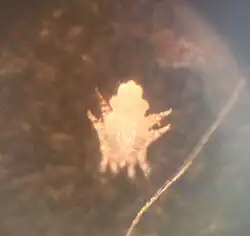 Самка клеща в отраженном свете микроскопа