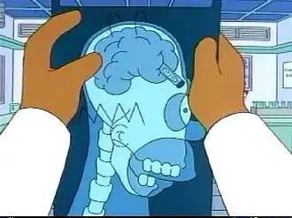 Рентген мозга Гомера