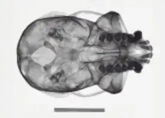 Рентгенограмма черепа