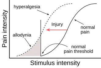 Гипералгезия и аллодиния