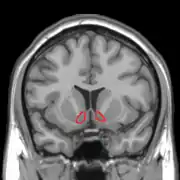 Коронарна проекція