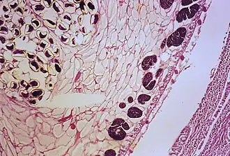 Часть взрослой особи лёгочной двуустки в просвете бронха, крупные фиолетовые пятна — созревающие яйца. Окрашенный гистологический препарат