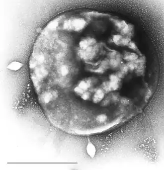 Sulfolobus, инфицированный вирусом Sulfolobus tengchongensis spindle-shaped virus 1 (STSV-1). В левой и нижней частях фотографии видны две вирусные частицы веретеновидной формы, отпочковывающиеся от клетки археи. Масштаб = 1 мкм