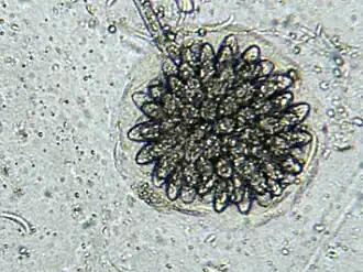 Rhopalomyces elegans