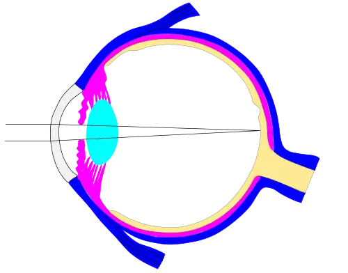 This is an Inkscape document with different layers for each component, making it easy to change the rays and the pupil dilation.