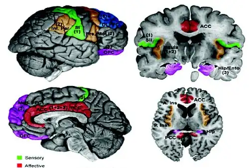 Centers of the Brain effected by pain